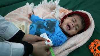 Starving Yemeni children