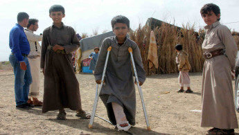 Yemeni children suffer amputations because of landmines