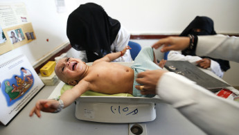 Yemeni starving children