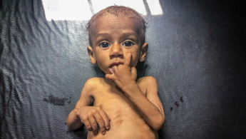 yemen hunger [save the children]