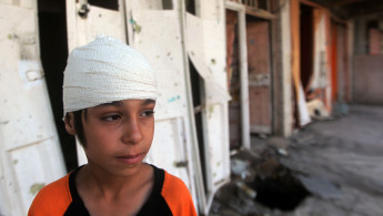Iraqi boy injured AFP