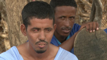 mauritanian blindness AL ARABY AL JADEED