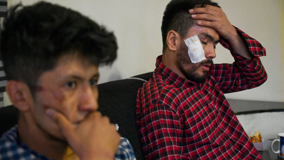 In this picture taken on September 8, 2021, Afghan newspaper Etilaat Roz journalists Nematullah Naqdi (L) and Taqi Daryabi show their wounds in their office in Kabul [Getty]