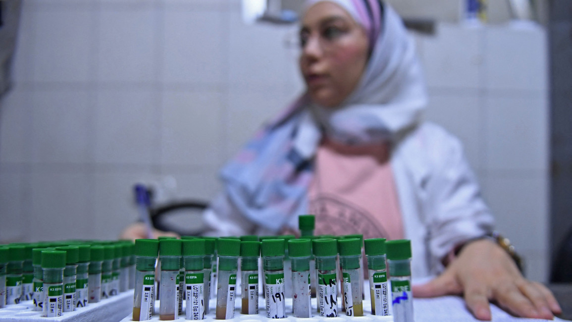 A lab technician works on samples to test for cholera
