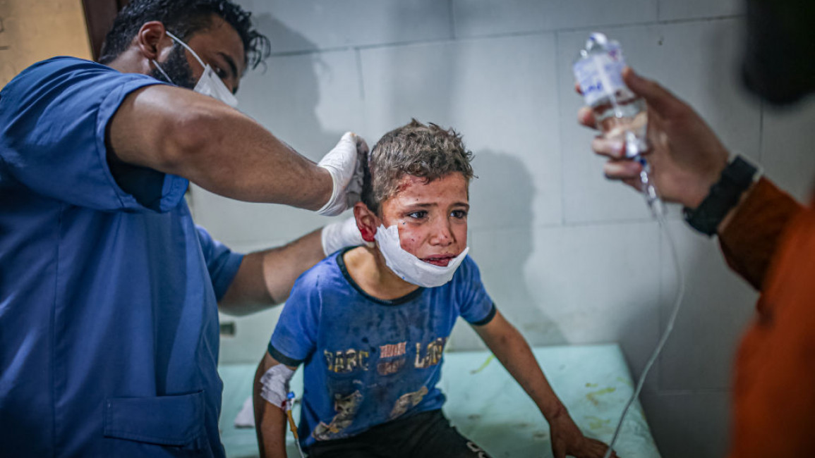 The children were injured in Assad regime bombing [Anadolu/Getty]