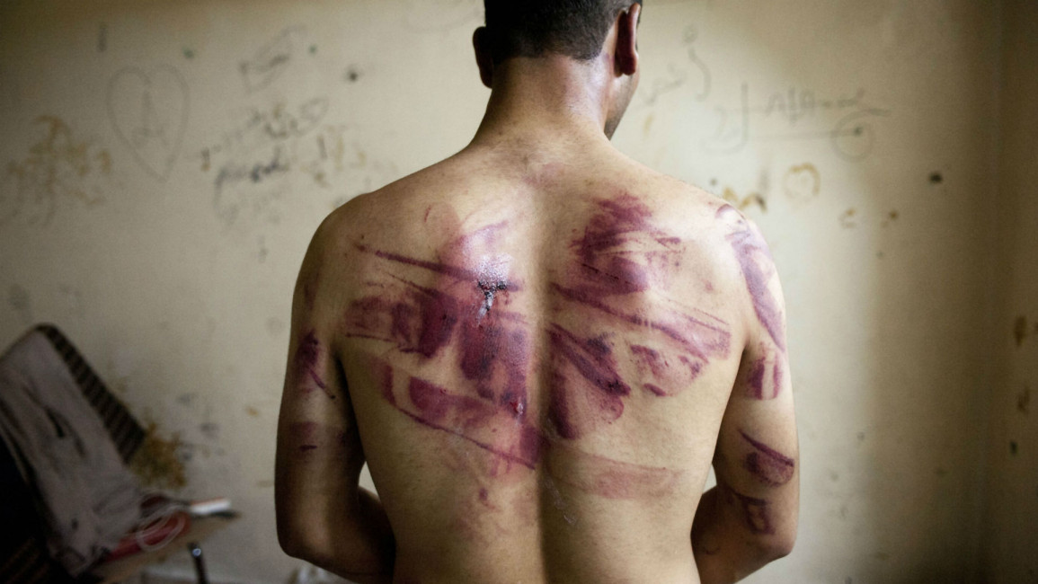 Torture Syria
