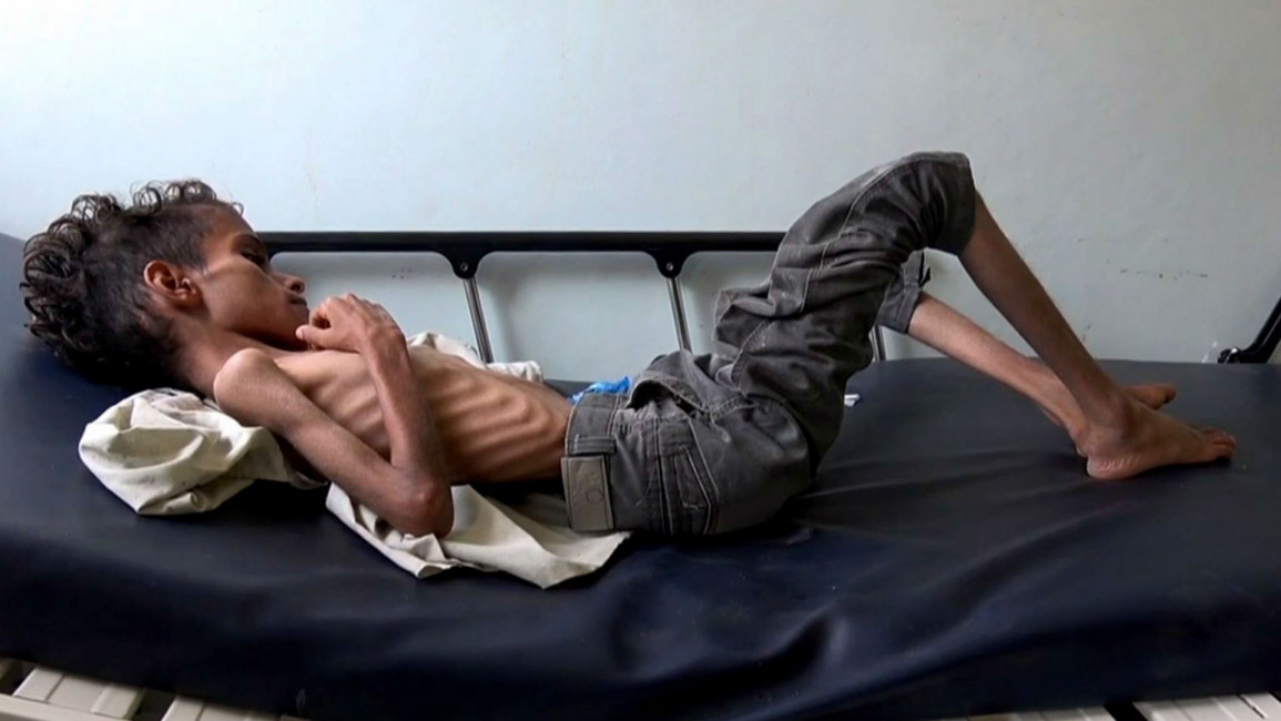 Yemen famine children getty