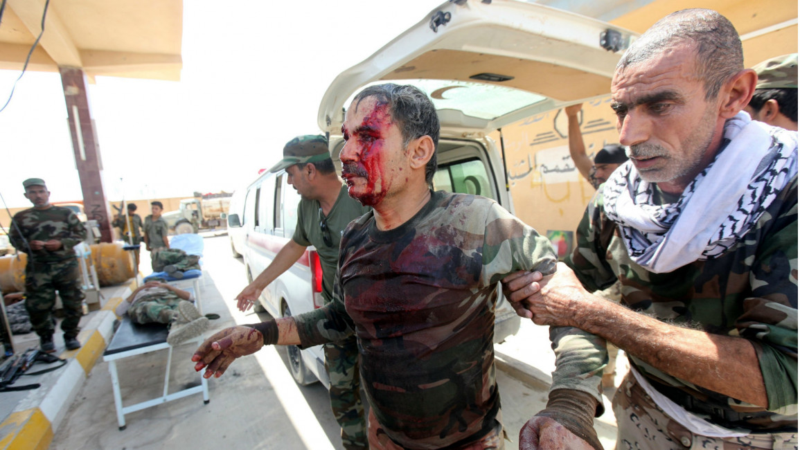 iraq soldier bloodied anadolu
