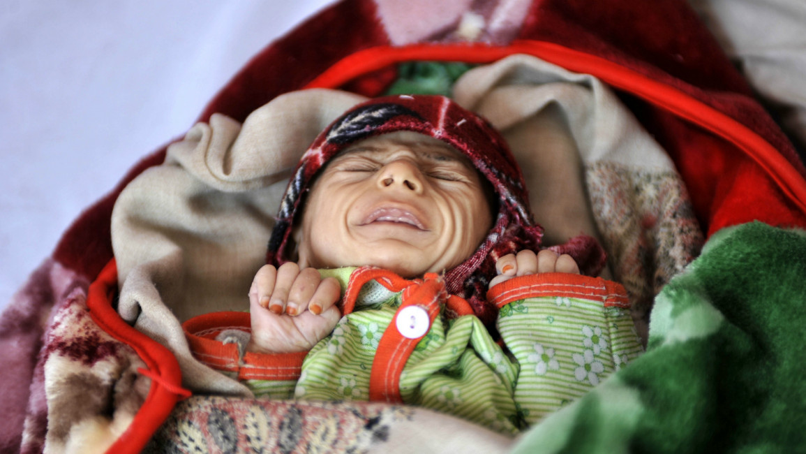 Yemen malnutrition