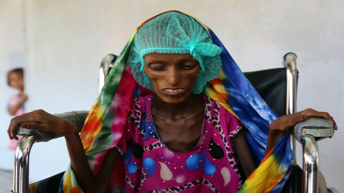 Yemen Famine AFP