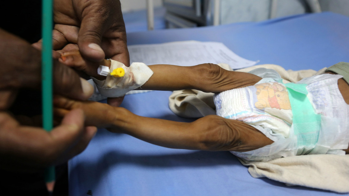 Yemen malnourished children